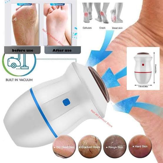 Back Electric Foot Vacuum Callus Remover (cell Operate)
