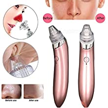 Derma Suction Pore Cleaning