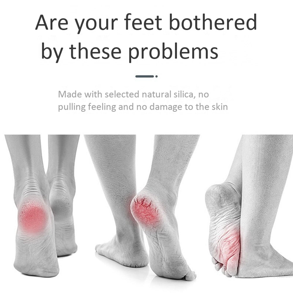 Back Electric Foot Vacuum Callus Remover (cell Operate)